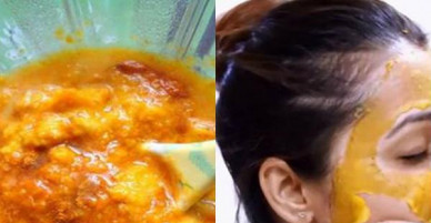 Cách lột sạch mụn đầu đen, mụn cám nơi cánh mũi, trán và cằm bằng vài chiếc vỏ cam phơi khô