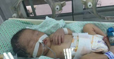 Sức sống mãnh liệt của thai nhi nghi bị mẹ đặt thuốc để ép sinh non
