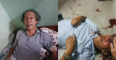 Bắt được bảo vệ chung cư hành hung dã man cụ ông