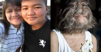 Ngắm mặt thật của cô gái “người sói” lần đầu cạo mặt