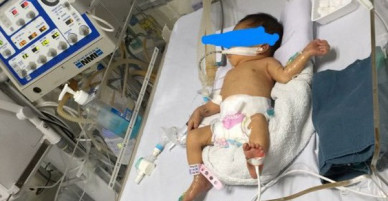 Bé gái 32 tuần tuổi nghi bị mẹ đẻ đặt thuốc ép cho chết để sinh non: Các bác sĩ tiên lượng xấu