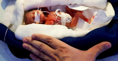 Bé gái sinh ra nhỏ xíu chưa bằng bàn tay, bác sĩ không dám tiên lượng điều gì thì 6 tháng điều kỳ diệu đã xảy ra