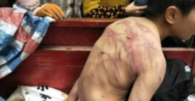 Bị bố mẹ đánh tím người, bé 10 tuổi mình trần ngủ dưới trời lạnh âm 2 độ