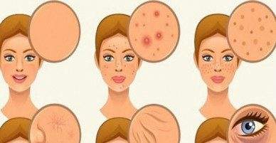 6 loại thực phẩm nếu ăn uống càng nhiều càng tích tụ chất độc trong da khiến da trở nên xấu xí