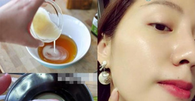 Muốn mặt trắng xinh, sạch mụn đón Tết, nhất định phải dưỡng da bằng dầu dừa theo cách này