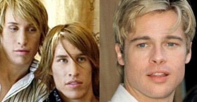 Muốn có ngoại hình như Brad Pitt để kiếm bạn gái, hai anh em sinh đôi chi mạnh 500 triệu đi phẫu thuật thẩm mỹ