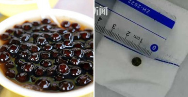 Cho con uống trà sữa trân châu, bà mẹ hốt hoảng khi con bị ho, sốt liên tục suốt nửa năm trời rồi phát hiện sự thật kinh hoàng
