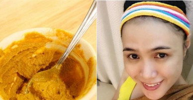 Mặt nạ nghệ mật ong có tác dụng trị bách bệnh về da, hiệu quả không thua kém gì 'thần dược'