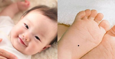 Sinh con có 3 nốt ruồi cực hiếm này, cha mẹ rung đùi cũng có tiền, giàu 3 họ, sướng 3 đời