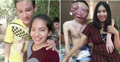 Dù chồng bị ung thư với khuôn mặt biến dạng, vợ vẫn một lòng ở bên chăm sóc: 3 năm, em vẫn yêu anh như ngày đầu