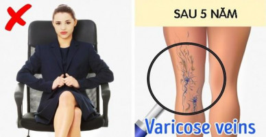 Nhìn những hình ảnh này chắc chắn bạn sẽ giật mình mà đứng lên 2 giờ một lần