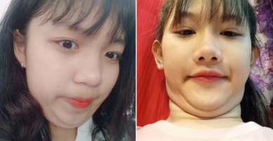 Khoe cằm V-line xưa rồi, giờ khoe mặt nọng 2 cằm mới là mốt cơ!