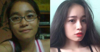Chùm ảnh: Những nam thanh nữ tú giành thắng lợi vẻ vang trong cuộc chiến dậy thì