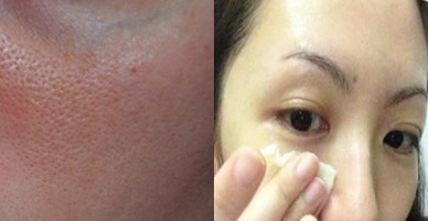 Bỏ lon soda vào tủ lạnh 5 phút rồi lấy nước ra ngâm mặt, lỗ chân lông tự động thu nhỏ sau 1 đêm, da tự trắng lên 3 tông sau 7 ngày