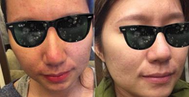 Tâm sự của cô gái từng đi xin việc 3 nơi đều bị từ chối vì mặt mụn
