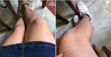 Chùm ảnh: Còn gì khổ hơn những cô nàng phận là con gái nhưng lông mọc còn rậm hơn con trai