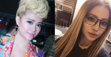 MiA xuất hiện với gương mặt khác lạ, công khai hình ảnh phẫu thuật thẩm mỹ