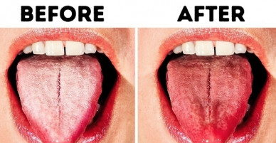 Những mẹo hay giúp bạn dọn sạch mảng bám trên lưỡi nhanh gọn nhất