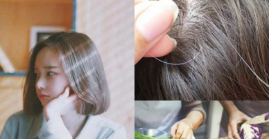 Mới 25 tuổi đã có tóc bạc trên đầu, đây là 4 nguyên nhân gây ra điều này
