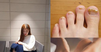 Thấy bàn chân có những dấu hiệu bất thường này, hãy đến bệnh viện ngay để kiểm tra kẻo không kịp