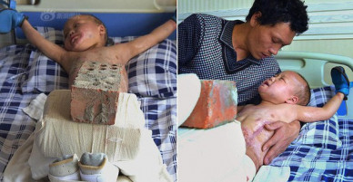 Xót xa chuyện người đàn ông bị vợ bỏ rơi, mỗi ngày dùng 15kg gạch đè lên chân đứa con 5 tuổi để chữa bỏng