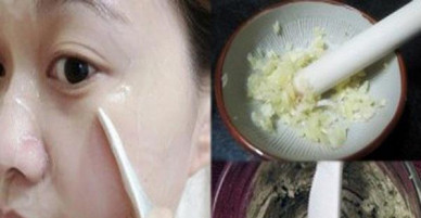 3 loại mặt nạ trị mụn cho da nhờn "cứu nguy" chị em ngay lần đầu tiên!