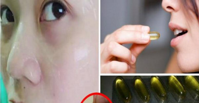 Sai lầm tai hại khi dùng khiến Vitamin E trở thành 'độc dược': Càng thoa da mặt càng xấu