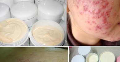 Kem làm trắng da toàn thân cấp tốc: Lợi có 1, hại đến 100