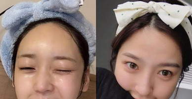 Ngoài Vitamin E, đây là 2 loại dưỡng chất không thể thiếu trong việc nuôi dưỡng làn da trắng mịn, tươi trẻ