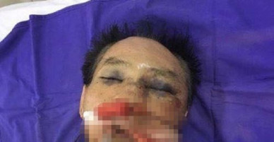 Anh em tương tàn vì mâu thuẫn xây nhà từ đường