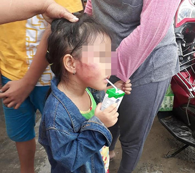 tin8, cô giáo đánh học sinh, cô giáo mầm non bạo hành học sinh, kẹp cổ và tát vào mặt liên tiếp