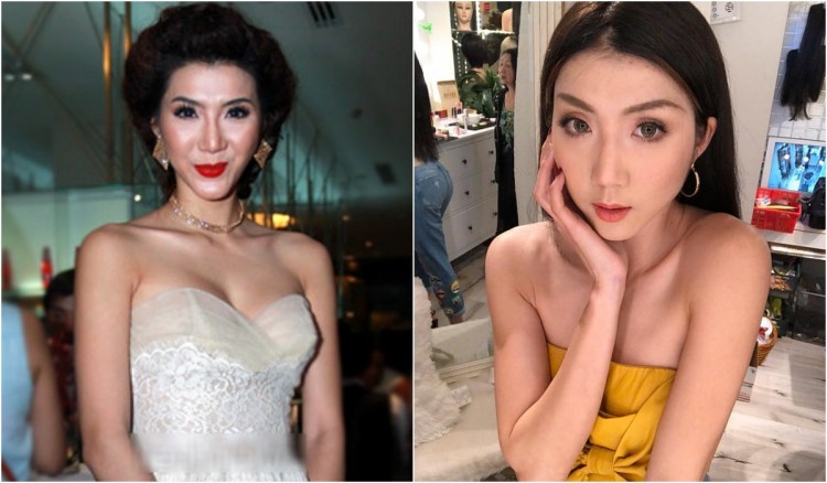 sao Việt, phẫu thuật thẩm mỹ, hư hỏng, hoại tử, khác lạ, công nghệ thẩm mỹ, thú nhận, ngoại hình, tin8